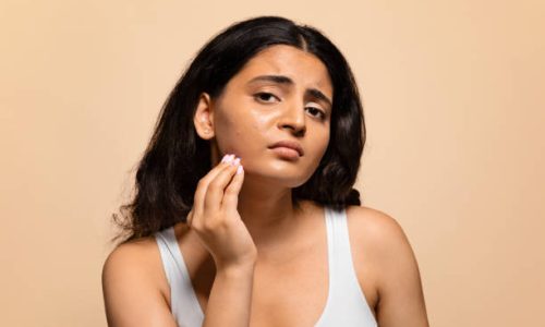 Upset Young Indian Woman Demonstrating Problems On Her Skin, Worried Eastern Female Touching Face And Looking At Camera, Stressed Lady Standing Isolated On Beige Studio Background, Copy Space